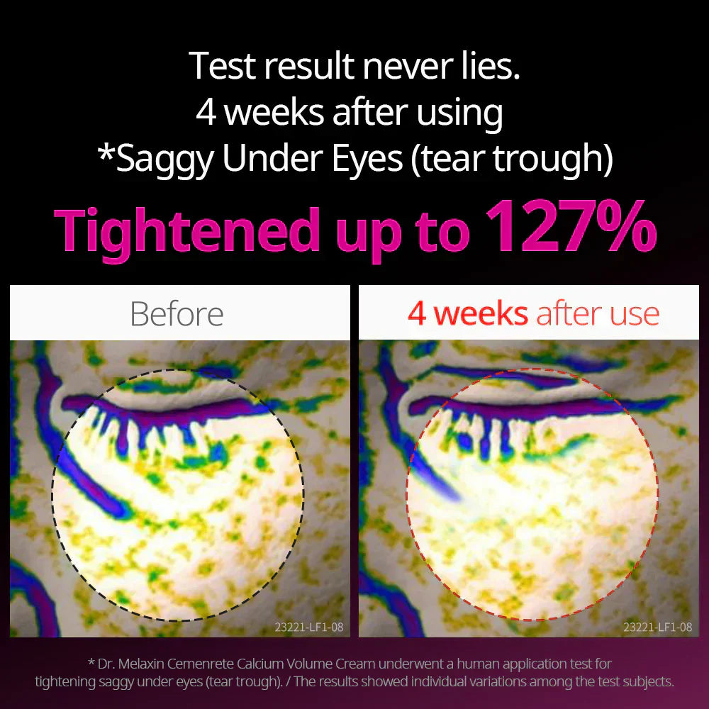 Cemenrete Eye care Line